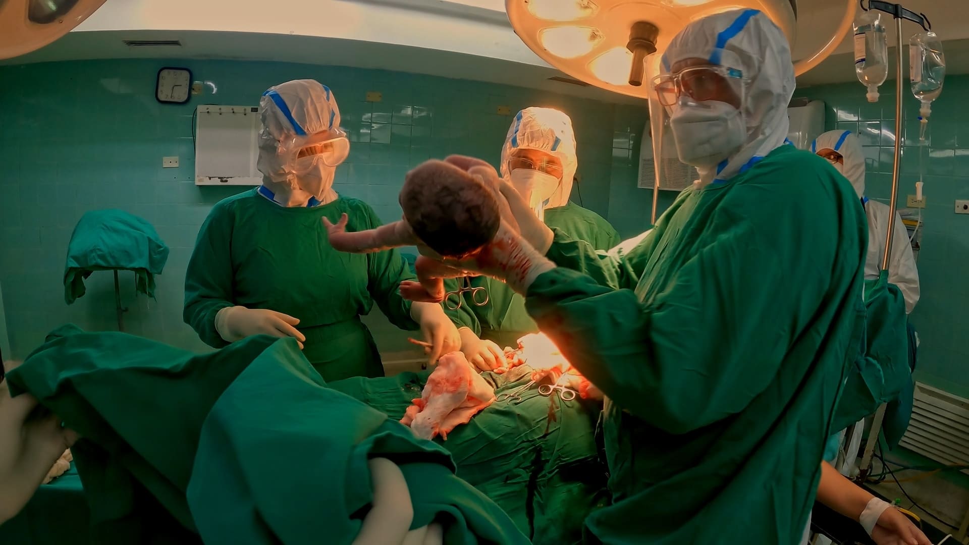 La naturaleza expuesta de la asfixia